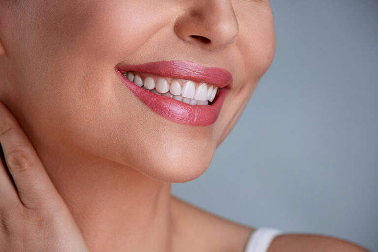 Laughing woman mouth with great teeth